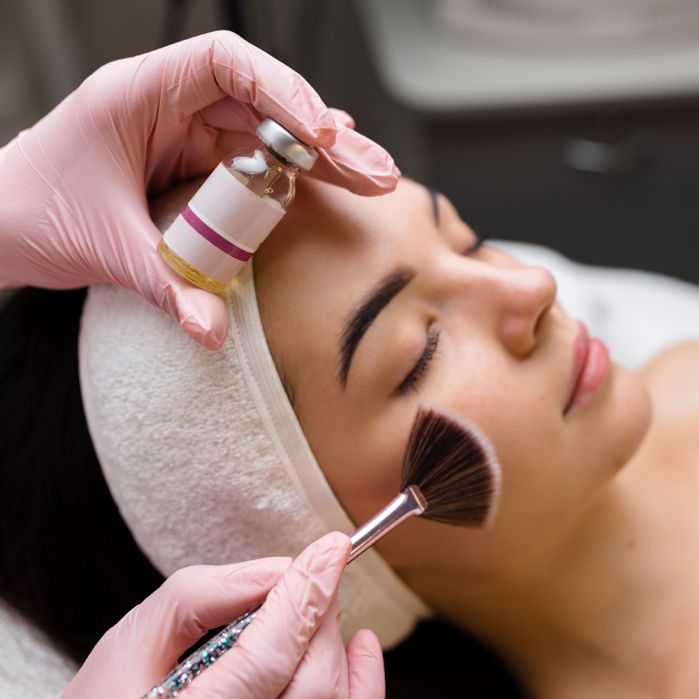 Chemical Peel