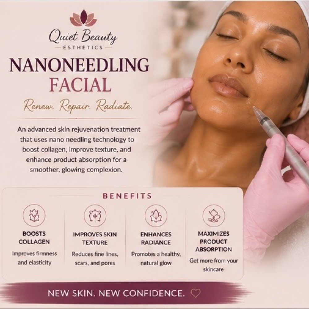 Nanoneedling Facial at Quiet Beauty Esthetics By Tamika in Columbia, SC