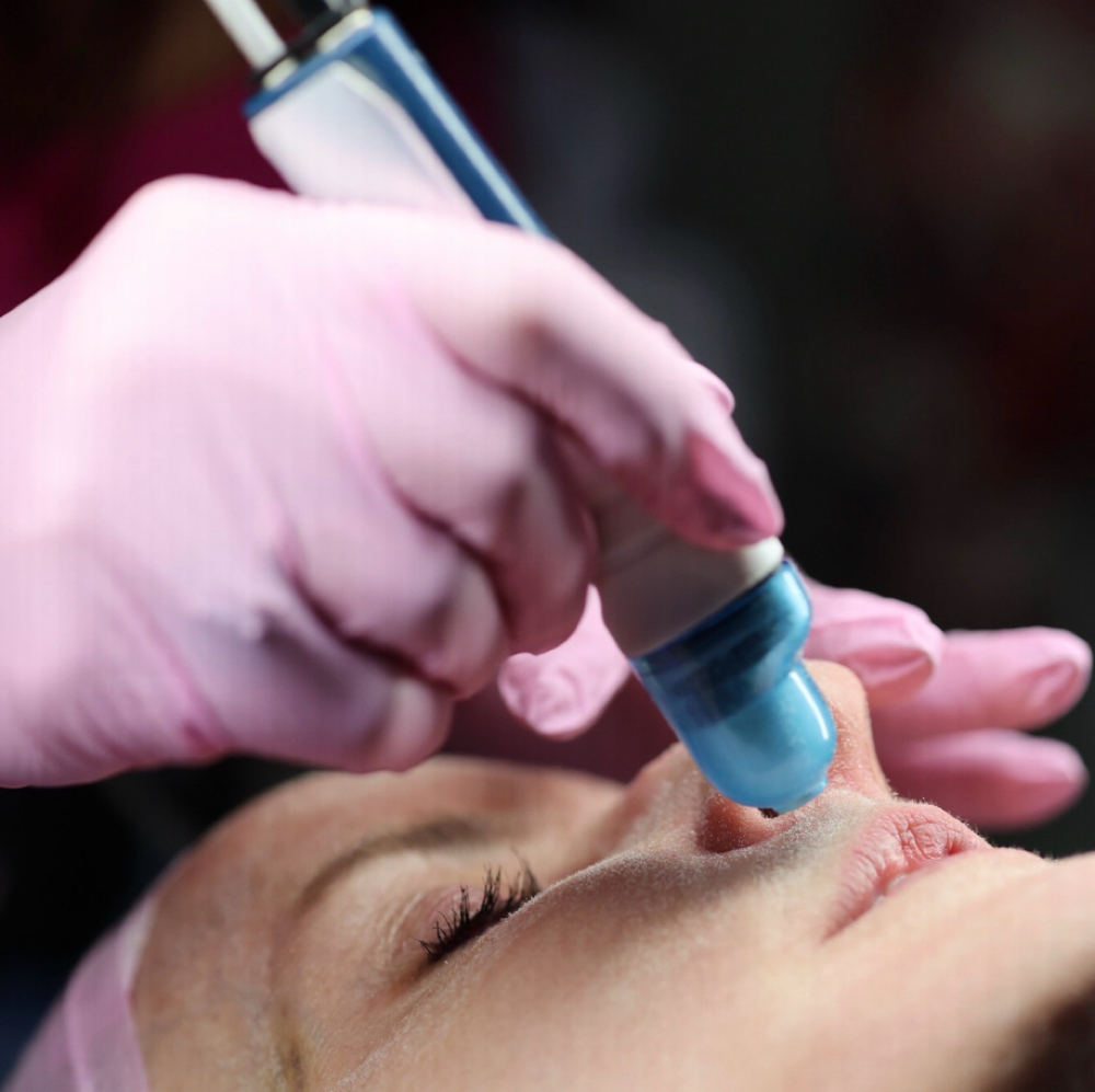 Microdermabrasion-PrePaid at Skin Studio 57 in Woburn, MA