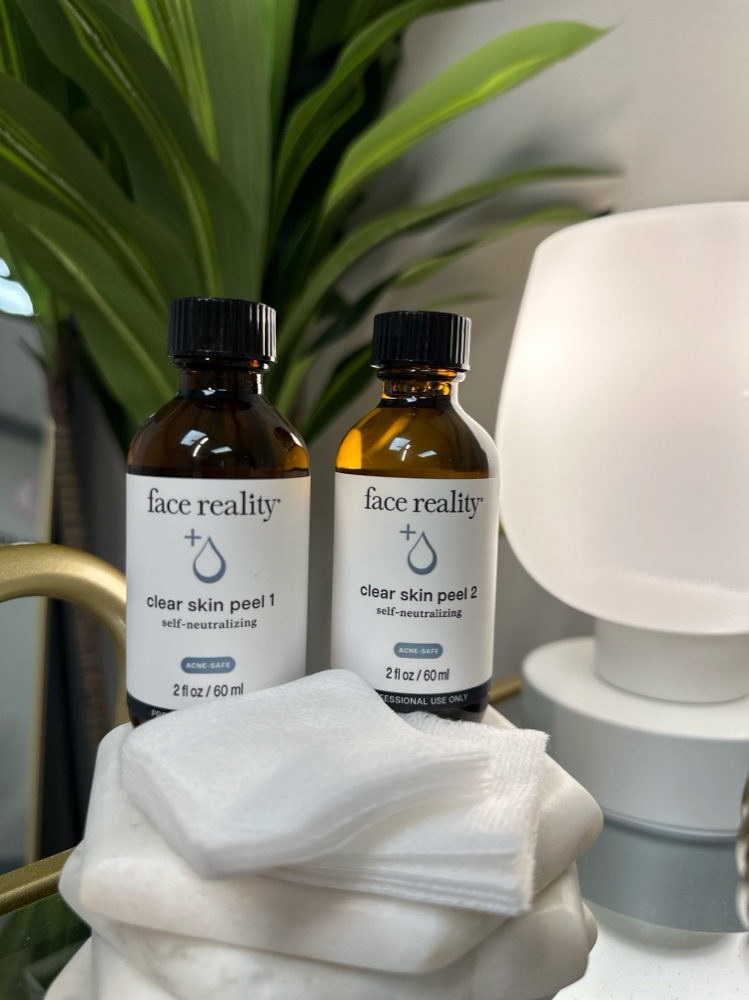 Acne Bootcamp Treatment