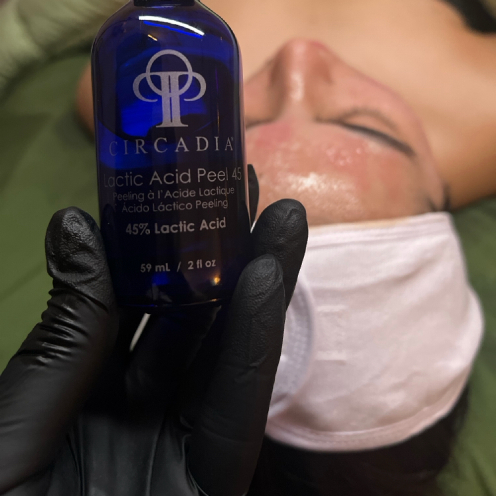 LacticAcid Peel Or Spot Peel Add On