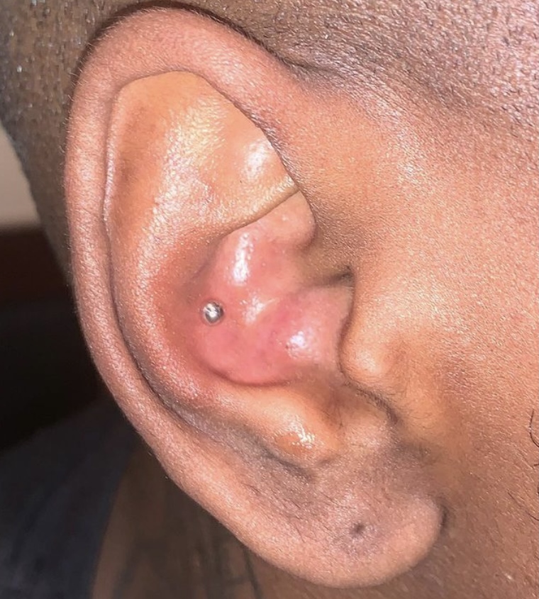 Conch