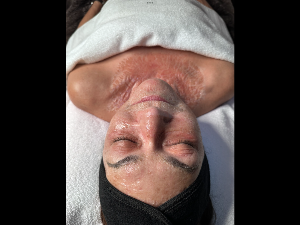 Firming Peptide Facial