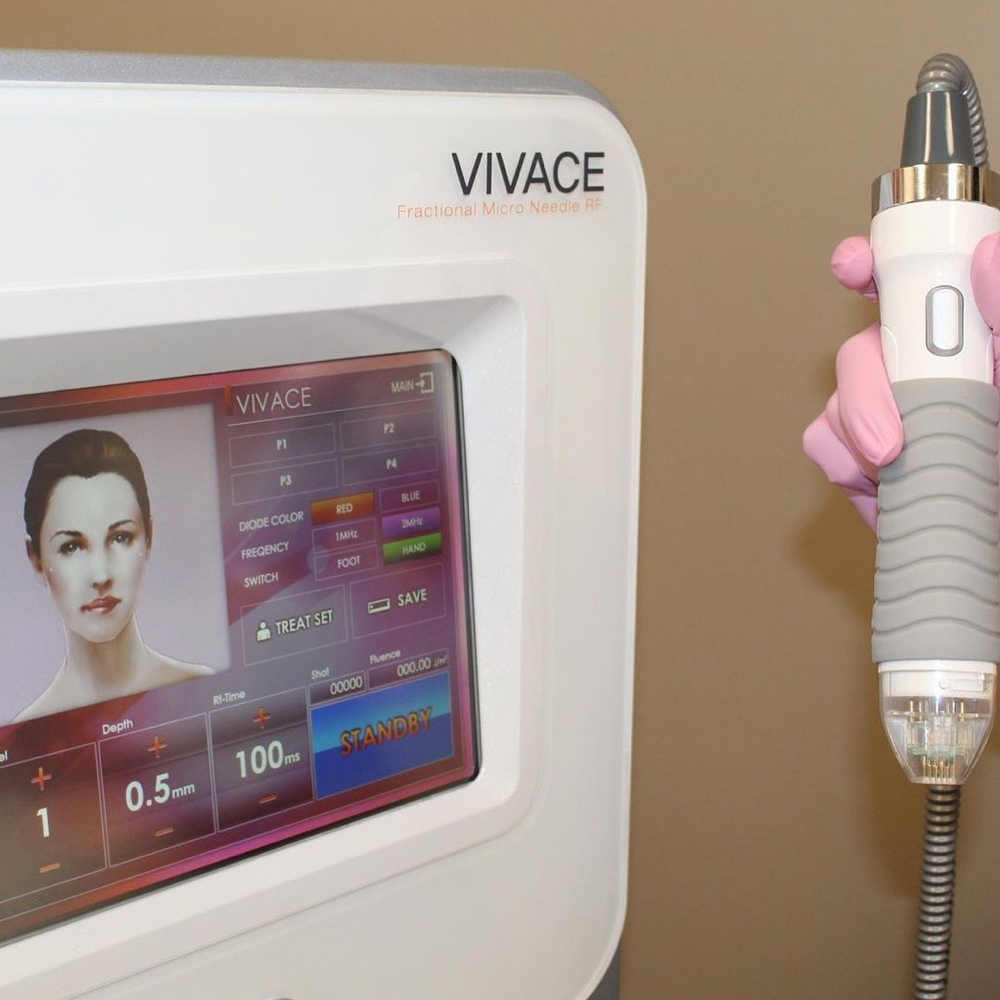 Vivace Rf 3 Treatments Face+neck