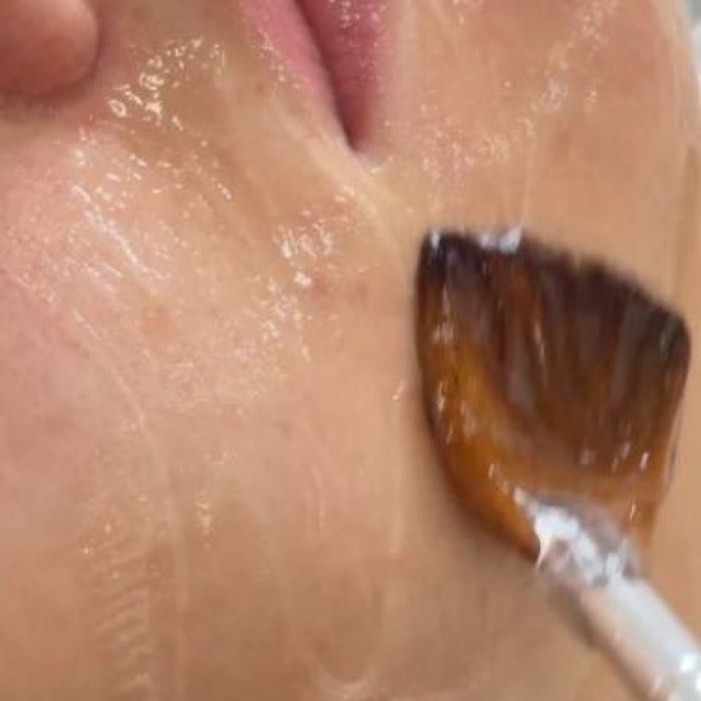 PDRN Skin Renewal Infusion Add-On at Glow by Allison in Grapevine, TX