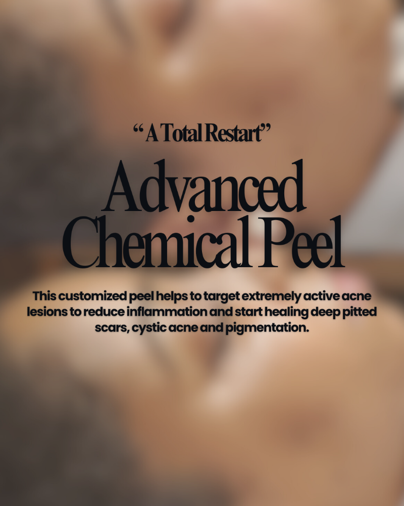 Advanced Chemical Peel