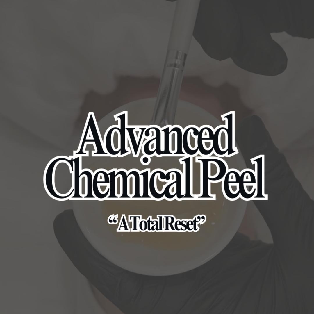 Advanced Chemical Peel at Rival Aesthetics in spring, TX