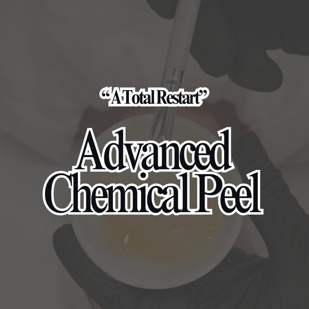 Advanced Chemical Peel at Rival Aesthetics in spring, TX