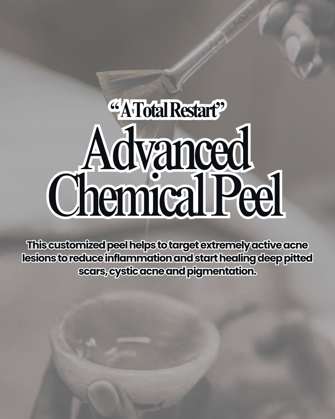 Advanced Chemical Peel