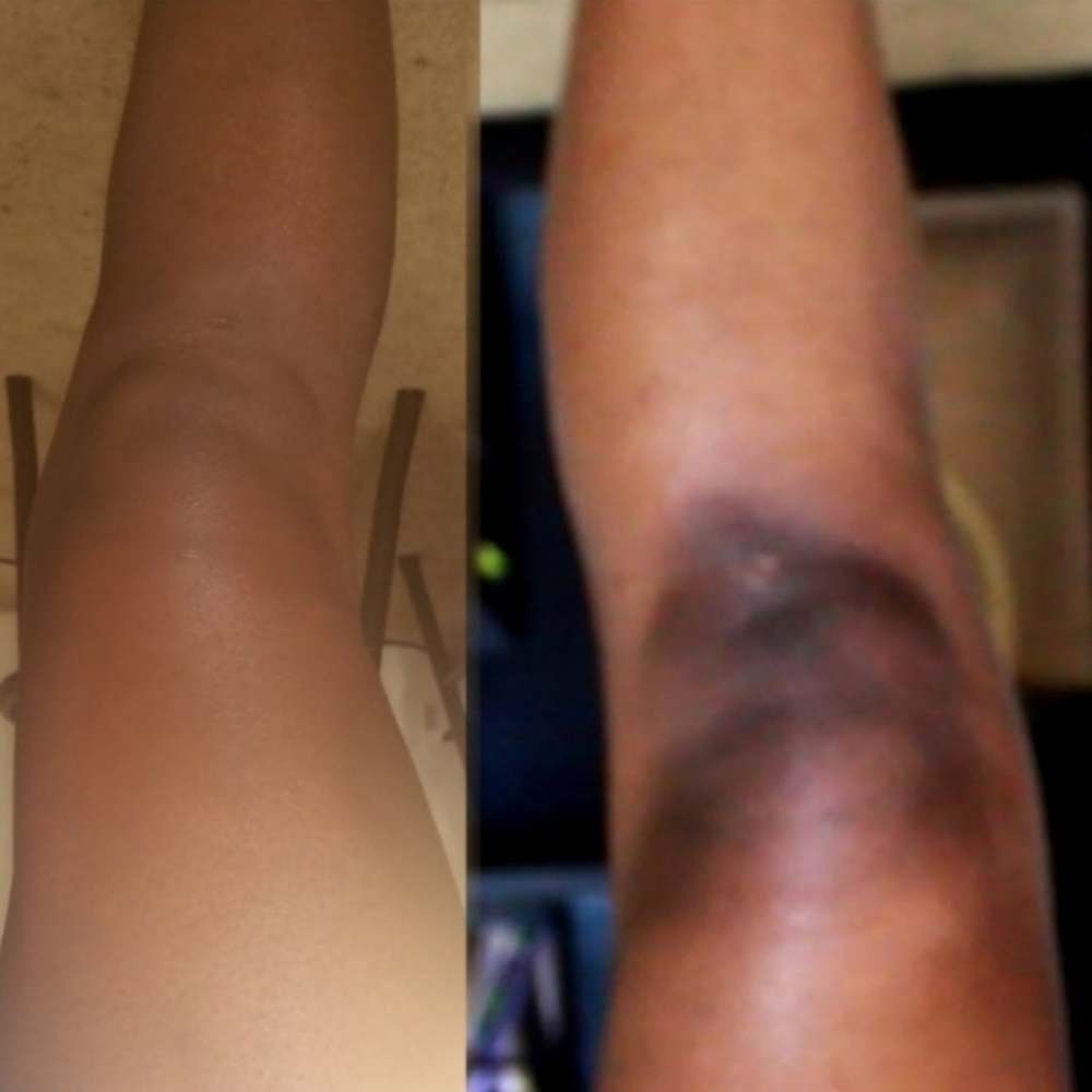 "Lighten Up" Skin Lightening Treatm at FACEZ BY MONICA in Lakewood, CA