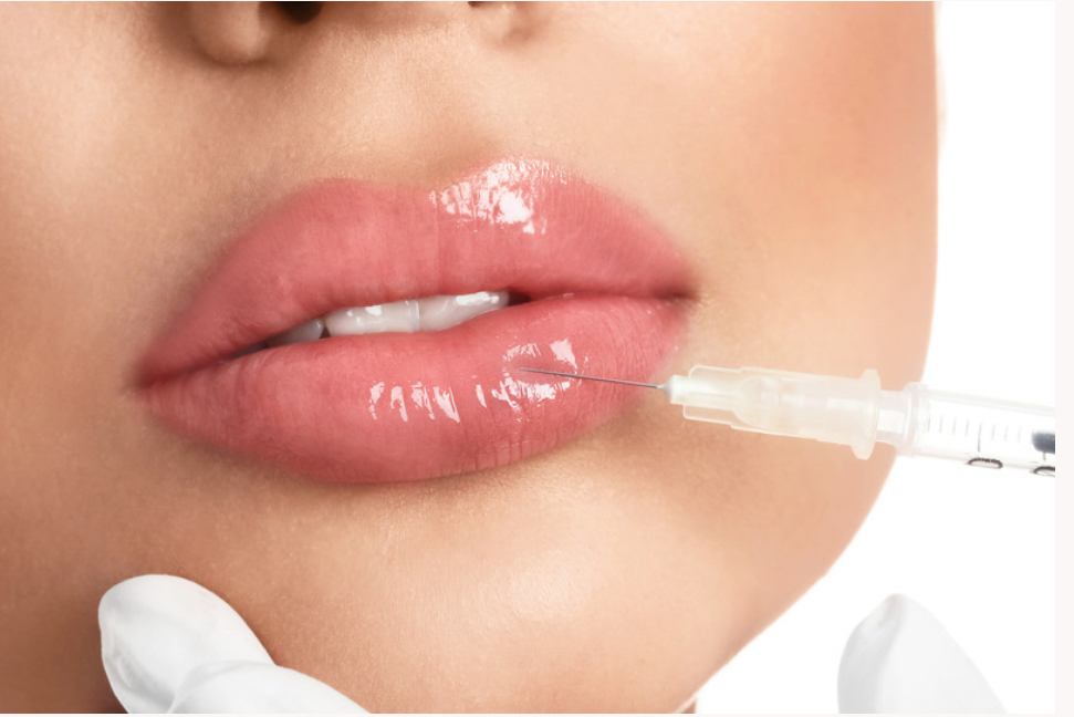 Lip Augmentation