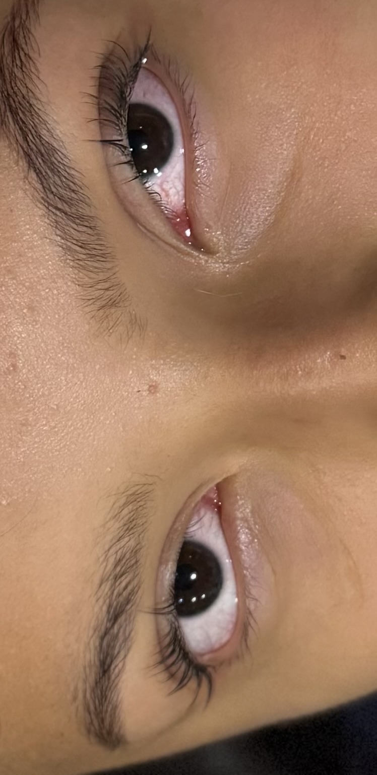 Lash lift