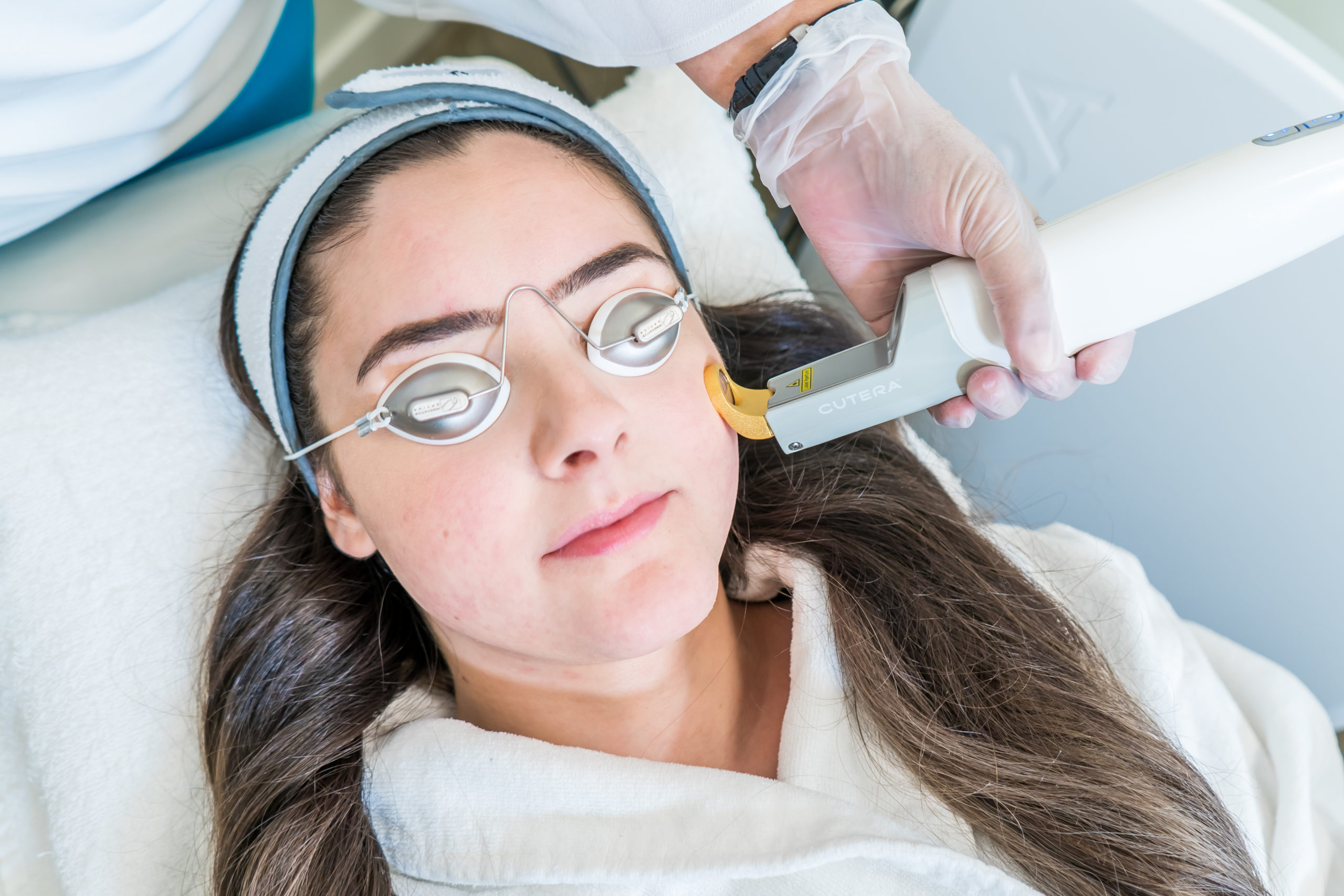Laser Vascular Treatment 1-20 min