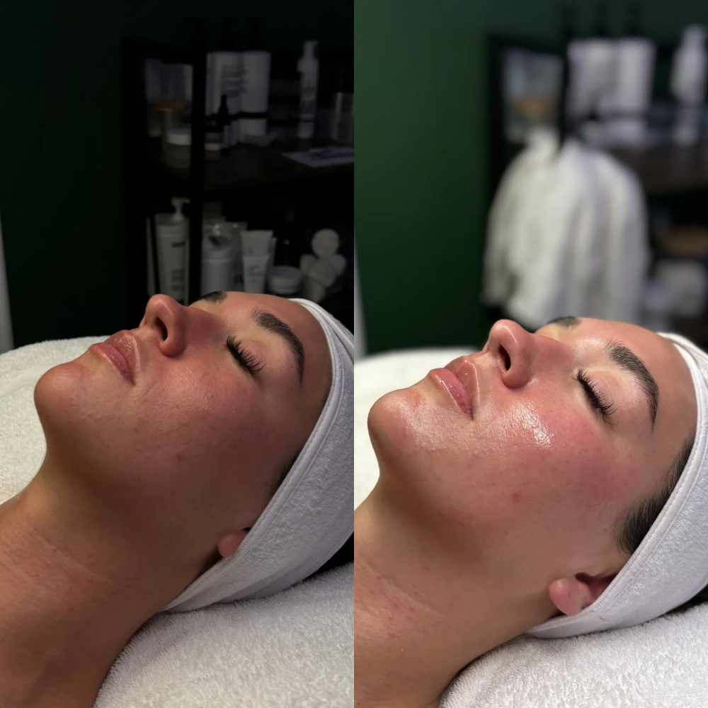 Skin Bar Sculpt & Glow Facial