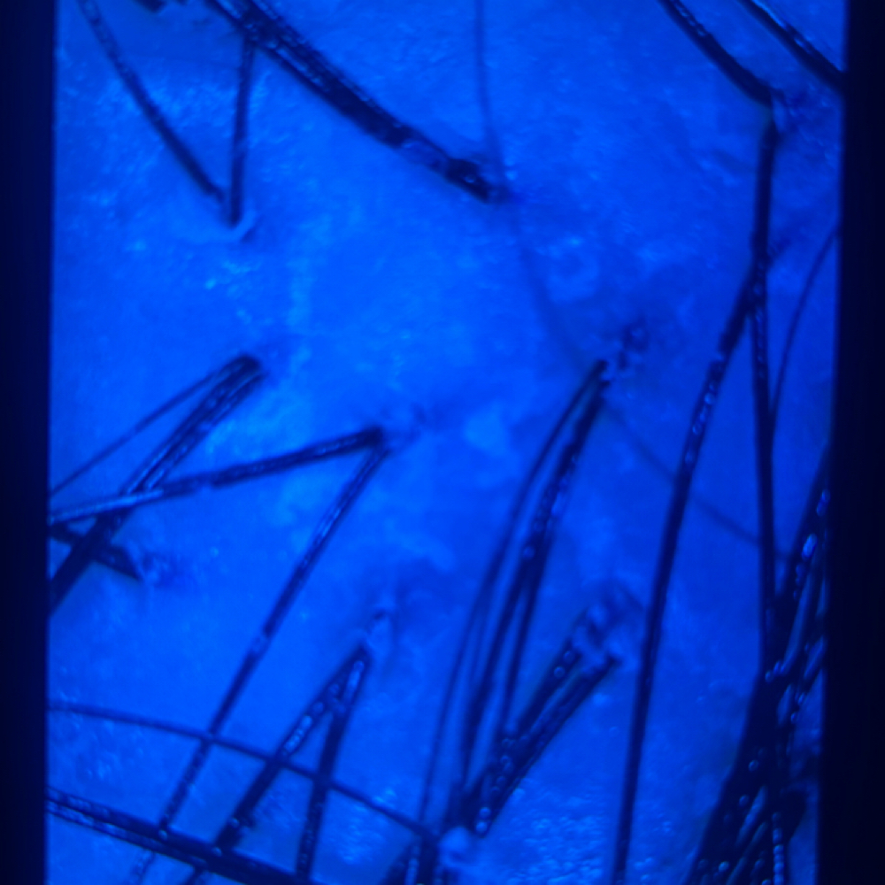 Stand Alone Scalp Treatment at First Street Oasis in Temple, TX