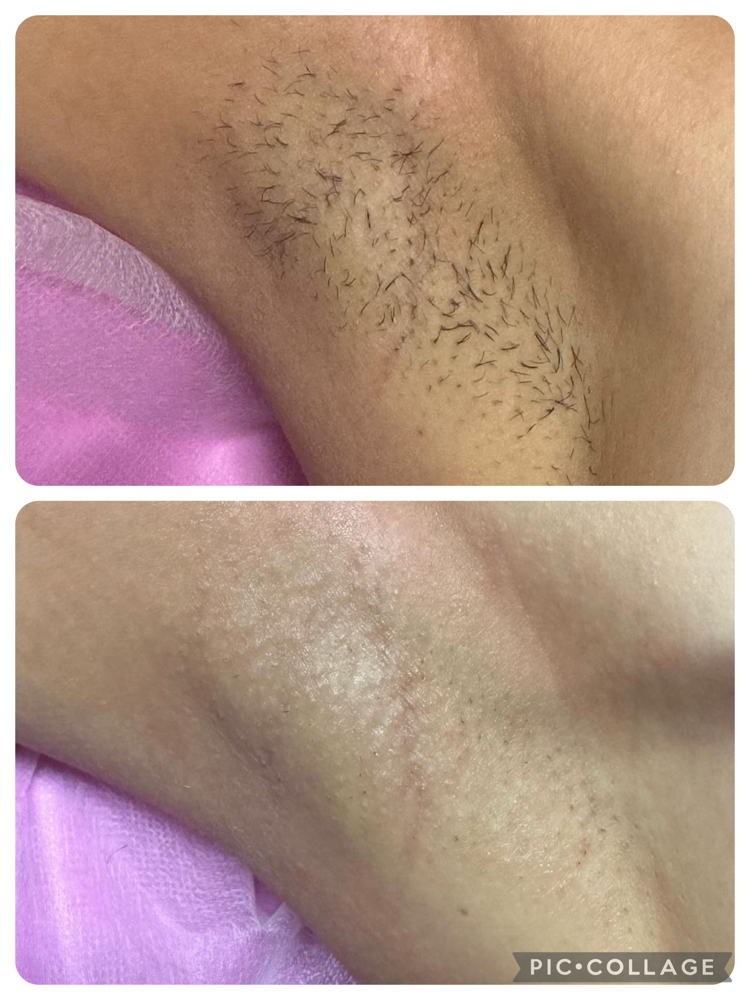 Underarm Wax