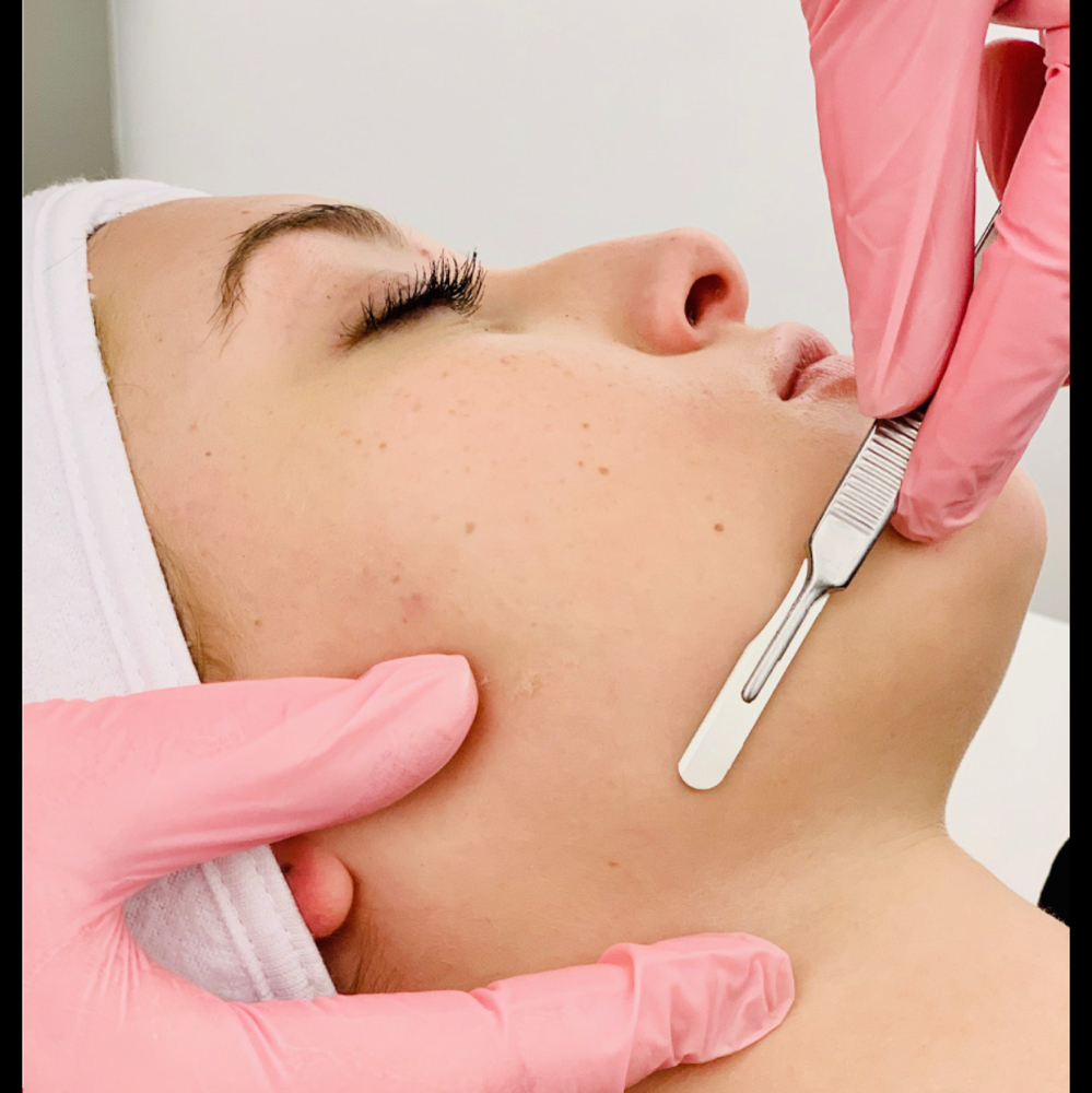 Dermaplane Facial