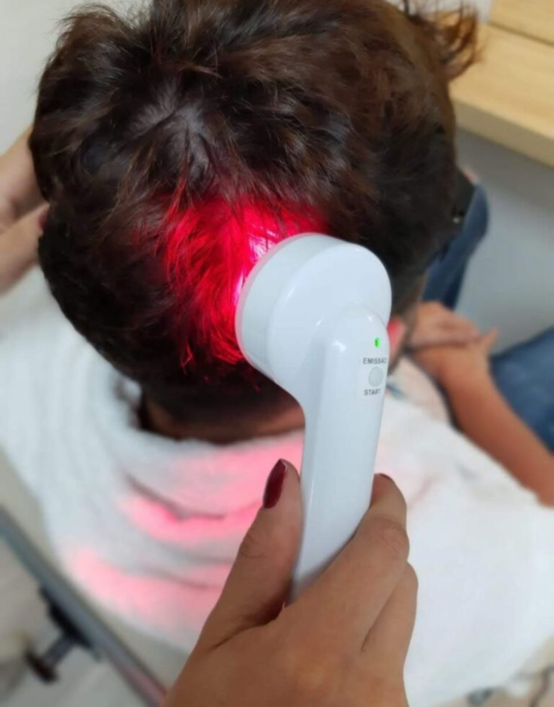 Hair Loss Treatment by Stress