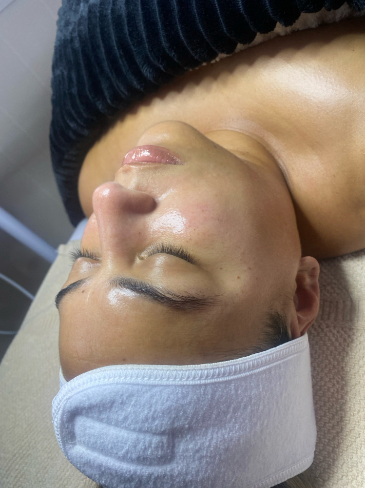Chemical Peel Facial