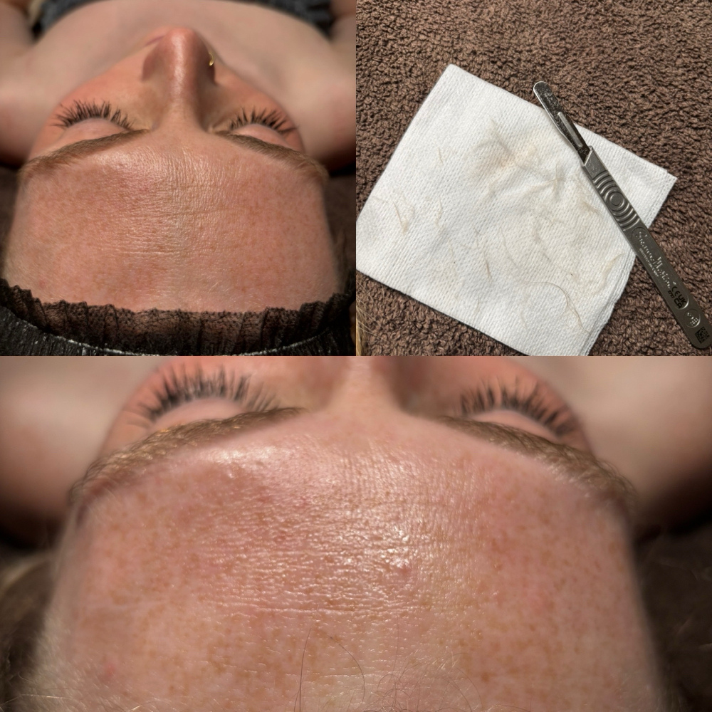 Dermaplane Facial at Ashley Lauren Esthetics in New Windsor, NY