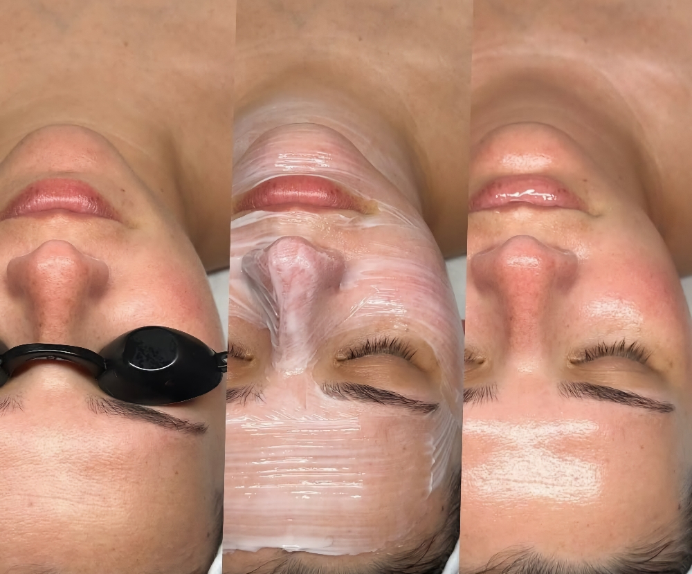 Signature Facial
