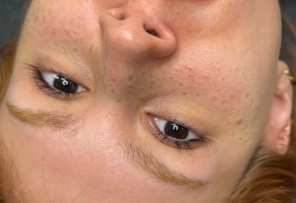 Semi-permanent Freckles