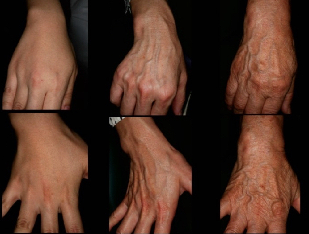 BB Glow Hand Rejuvenation at Mjartistry in Manahawkin, NJ