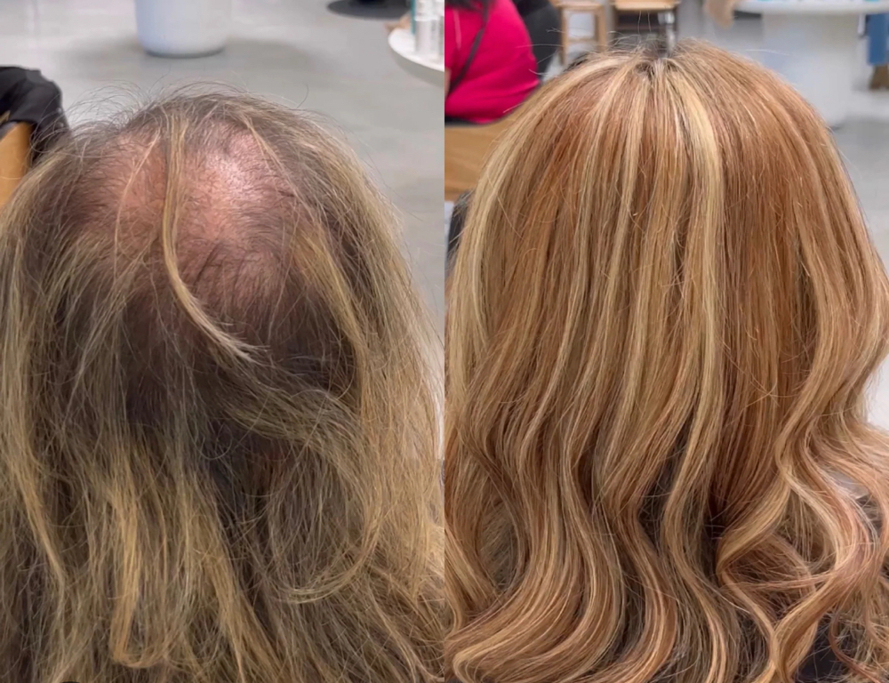 Integrated Weft Toppers