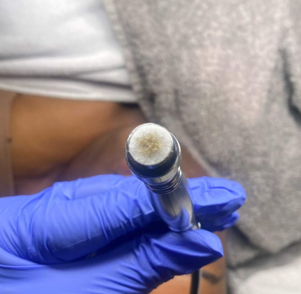 Microdermabrasion Facial at Jontahontas’ Collection LLC. in Greenville, SC