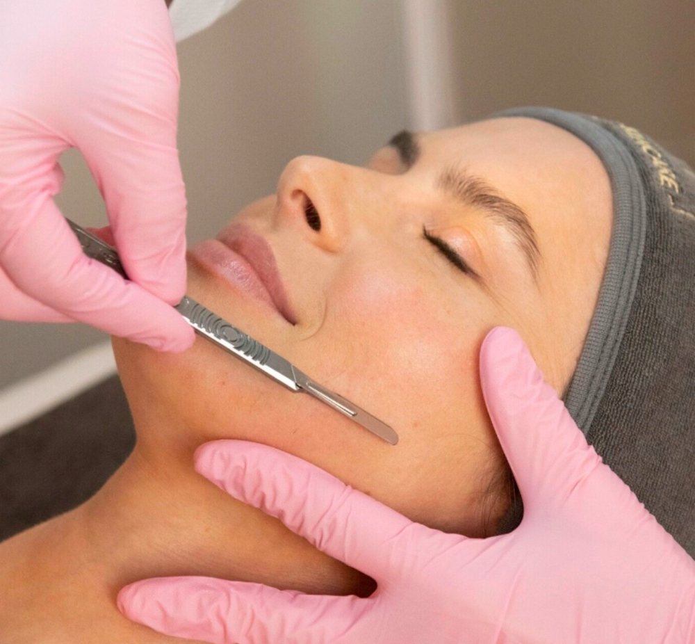 The Dermaplane Facial