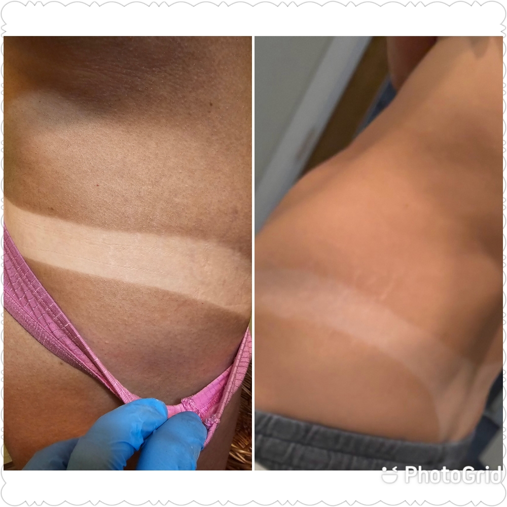 Norvell Venetian One Spray Tan at Alicia's Esthetics of Aynor in Aynor, SC