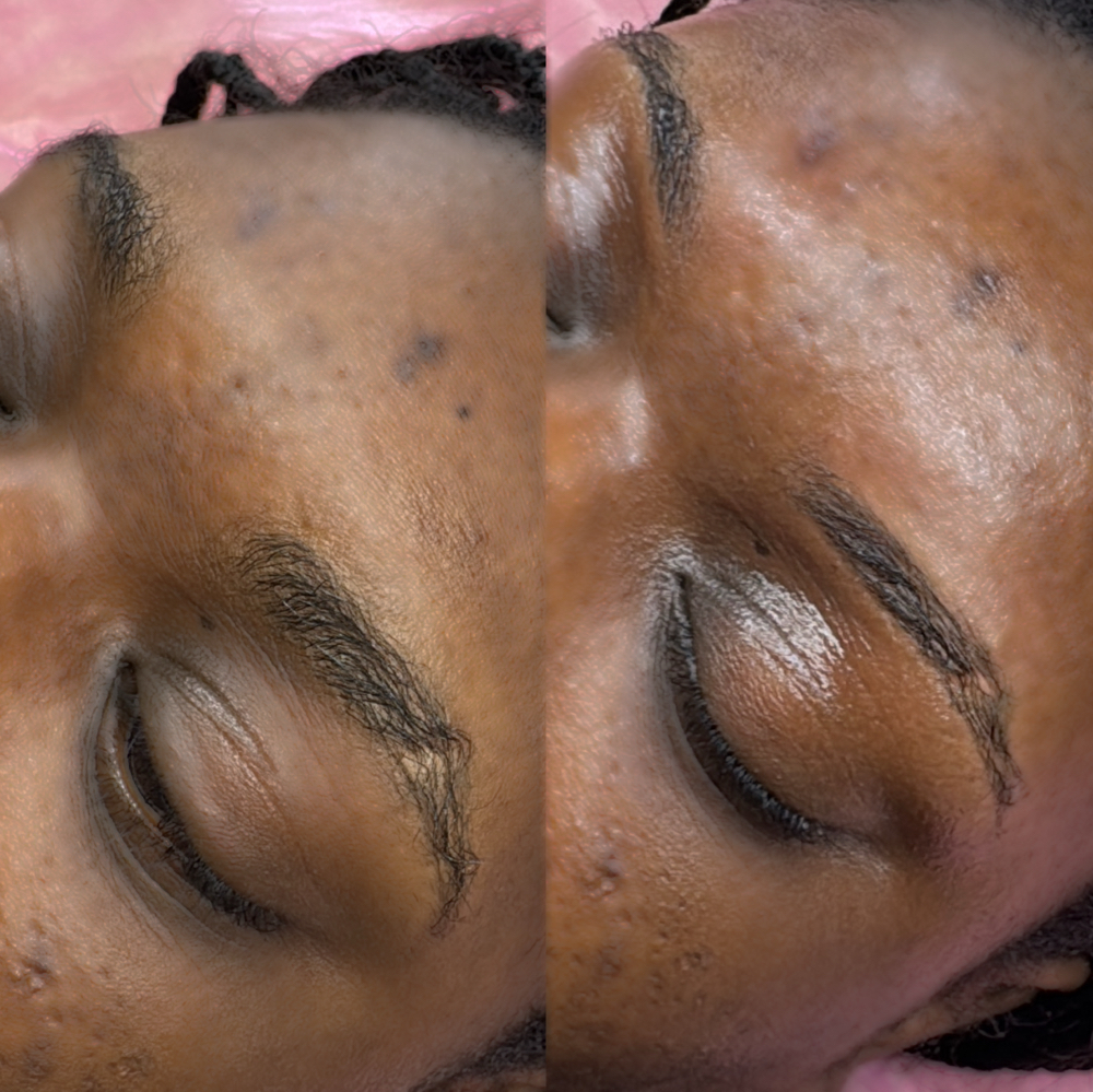 Brows