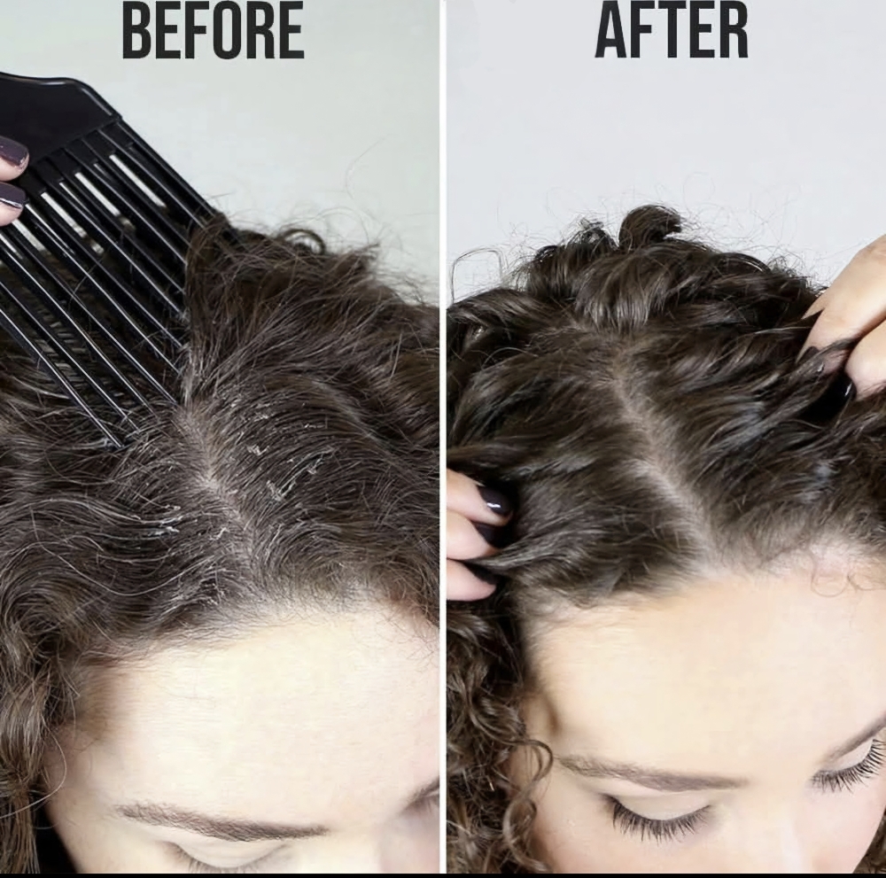 Scalp Purification Therapy