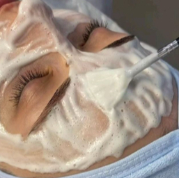 Peach Fuzz Renewal at WinksEsthetics in Hamden, CT