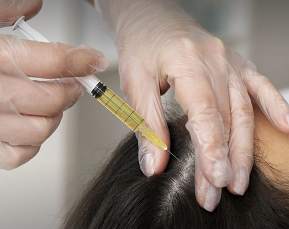 Crown revive PRP Hair at Y&M SKIN STUDIO in White Plains, NY