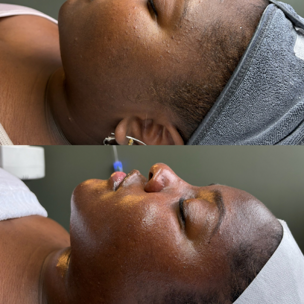 Lavish Classic Facial at Lavish Lauren in Bala Cynwyd, PA