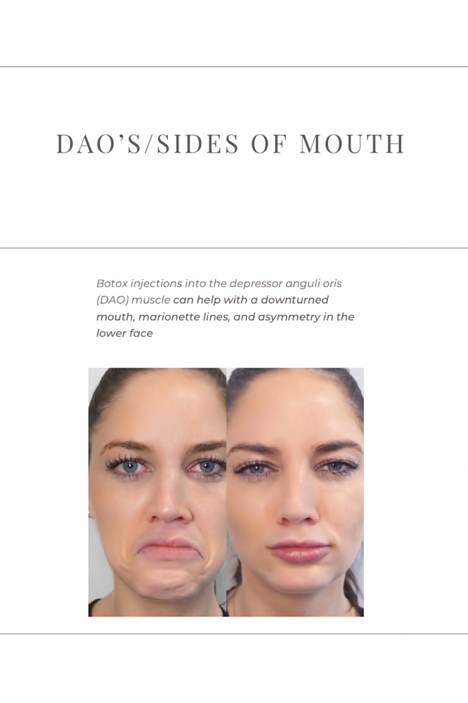 DAO’s/ Side Of Mouth