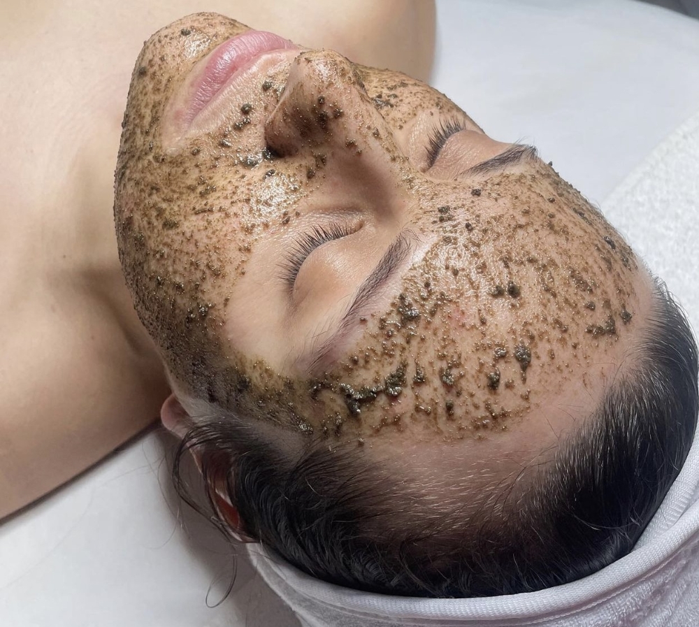 Liquid Microneedling Treatment
