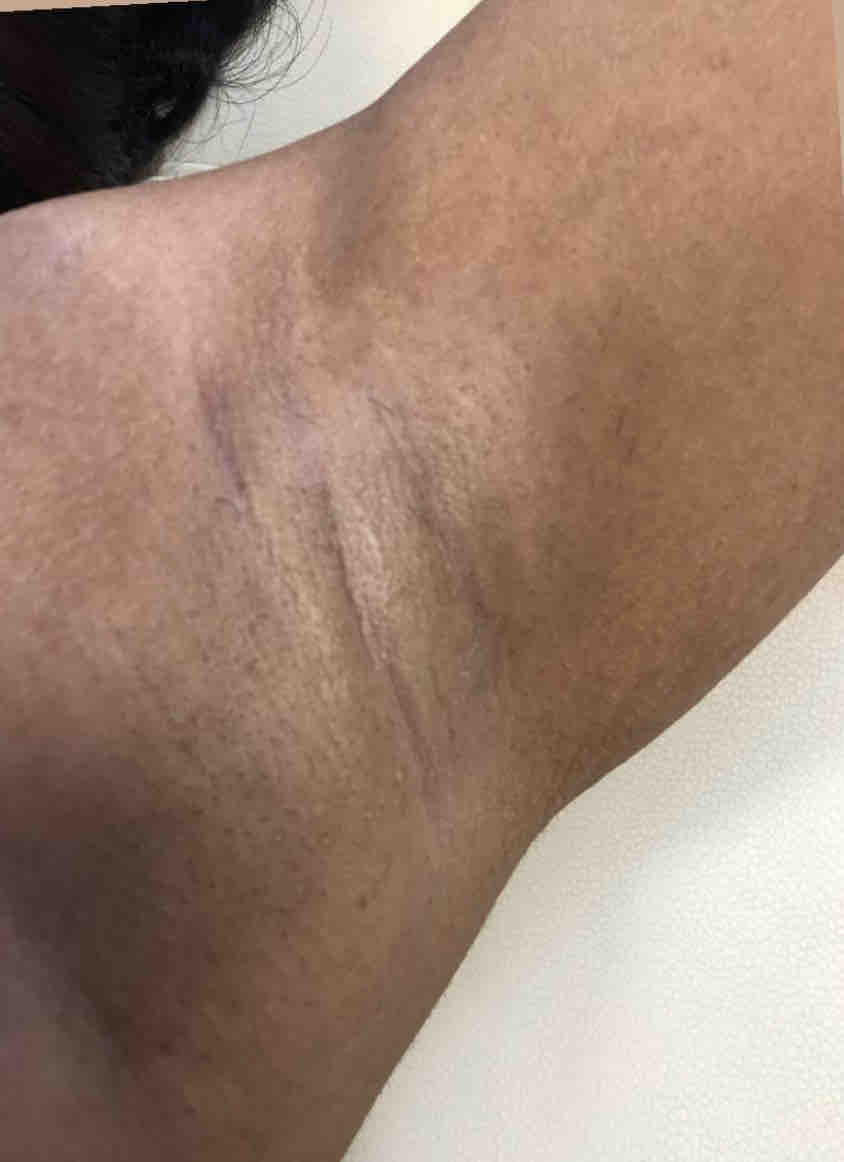 Under Arm