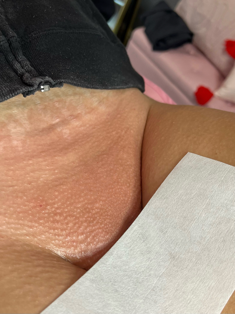 BRAZILIAN WAX