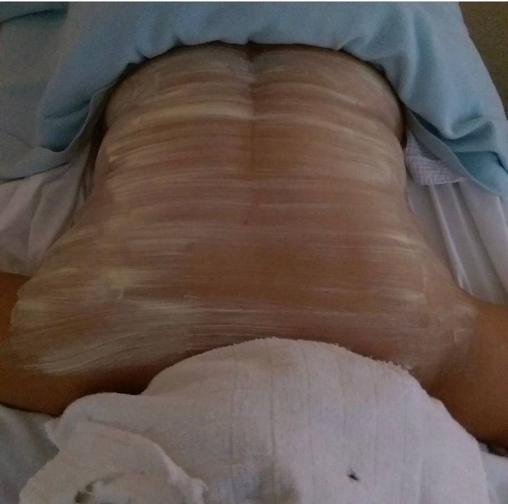 The Back Glow at Des Beauty & Skin in El Paso, TX
