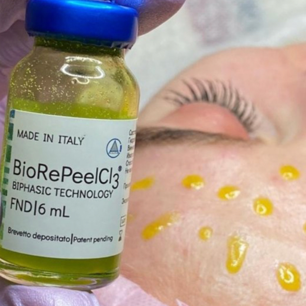 Full Face Peeling at Kelly Sorza Beauty Esthetic in San Jose, CA