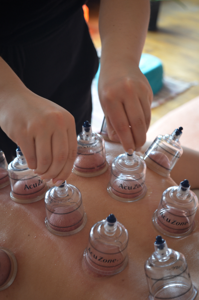 Cupping 90 Mins