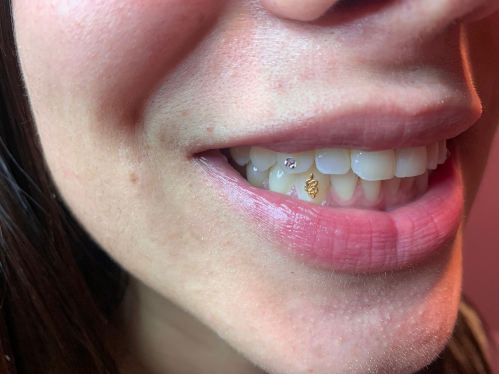 Tooth Gem Party