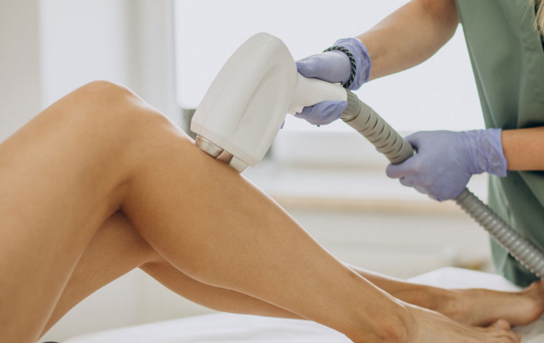 Laser hair removal Medium area