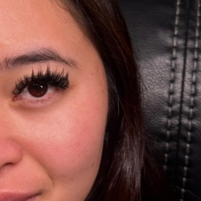 Maintenance fill - Anime at Garden Esthetics in Antioch, CA