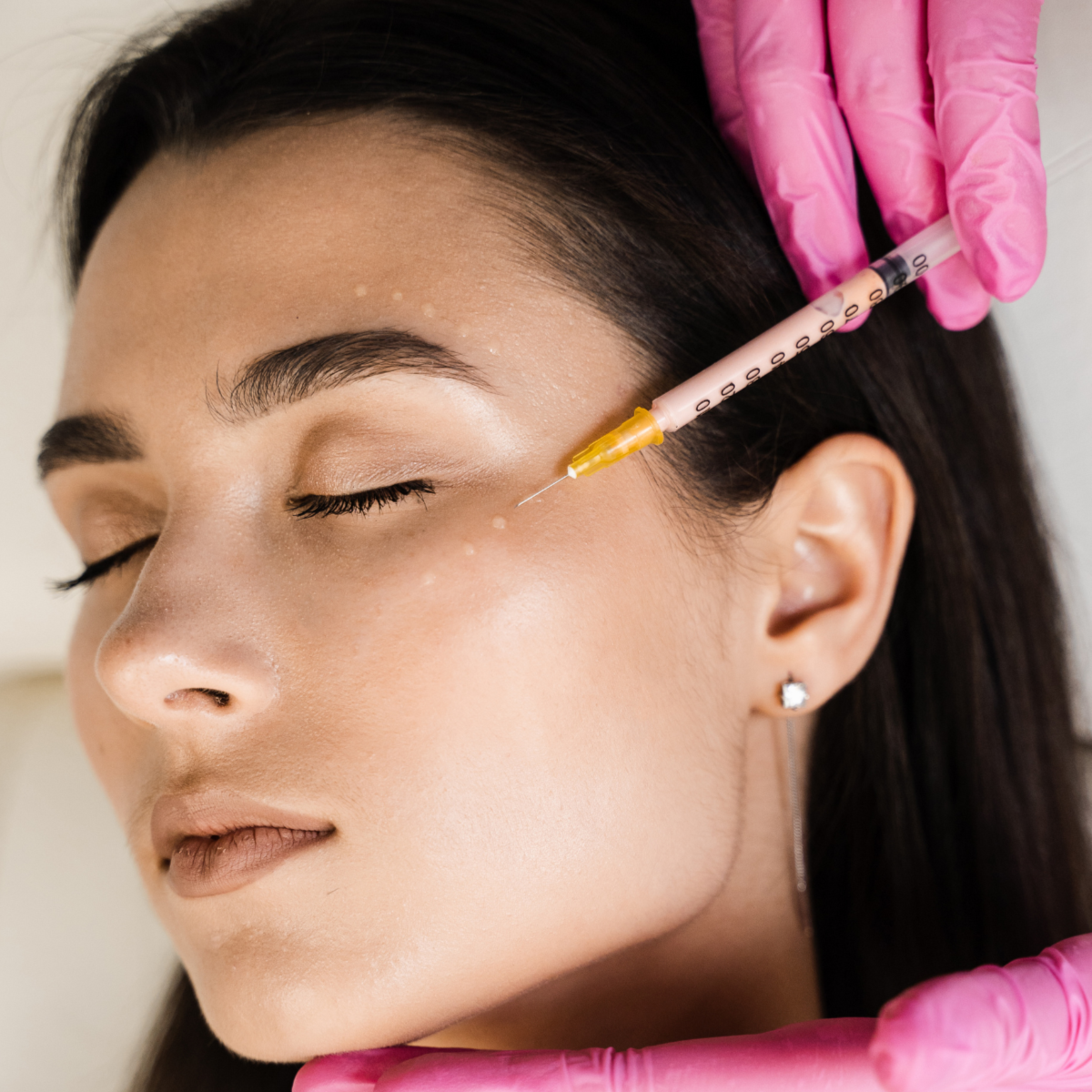 Botox- Crows Feet at JENNVIE Med Spa in Westport, CT