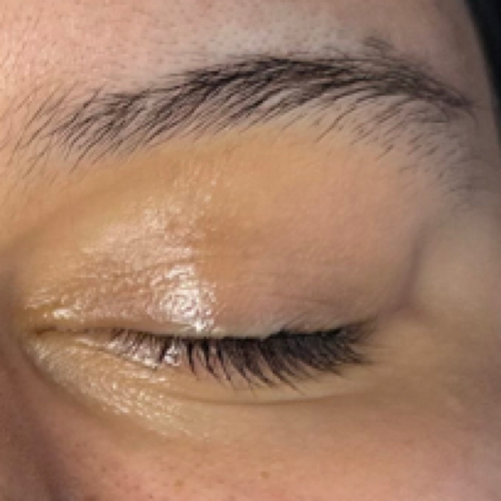Eye Brightening Treatment at Rooted Studio in Manchester, CT