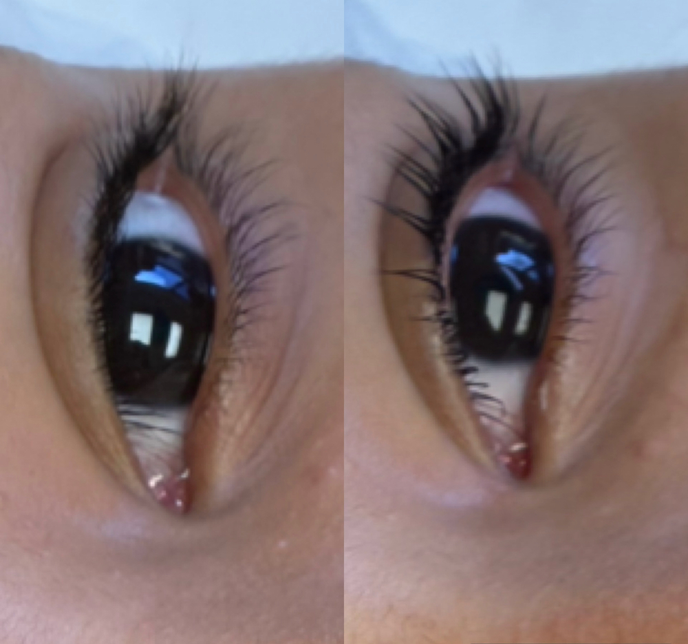 Eyelash Lifting