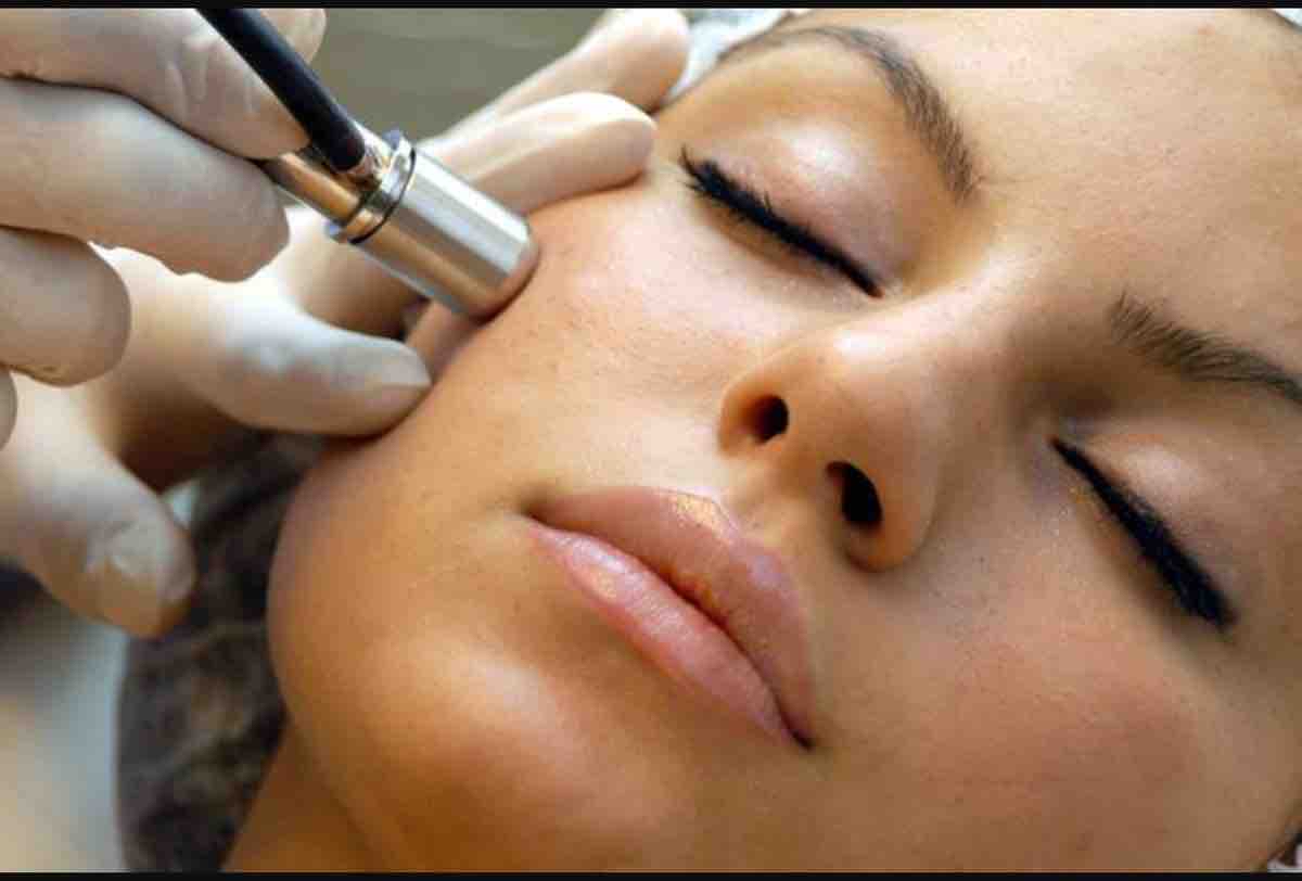 Microdermabrasion